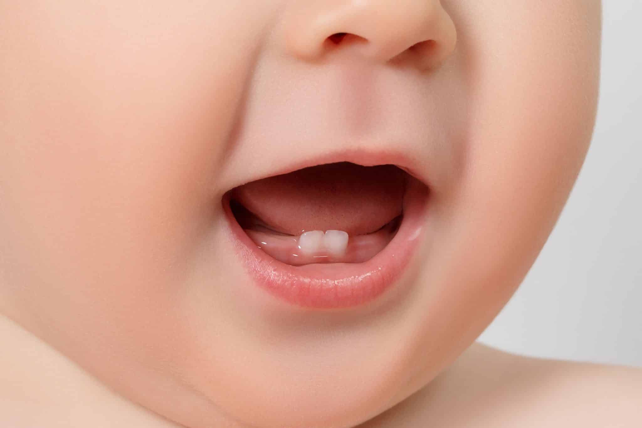 Picture of a baby with two front teeth.