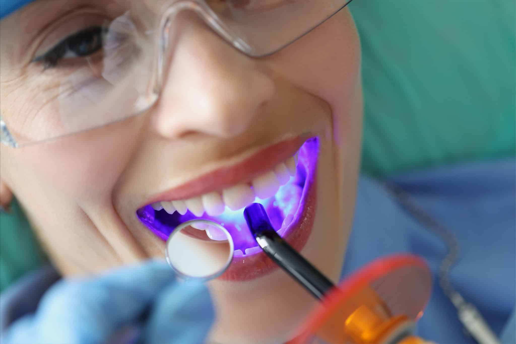 a woman getting her dental sealant hardened by a uv light