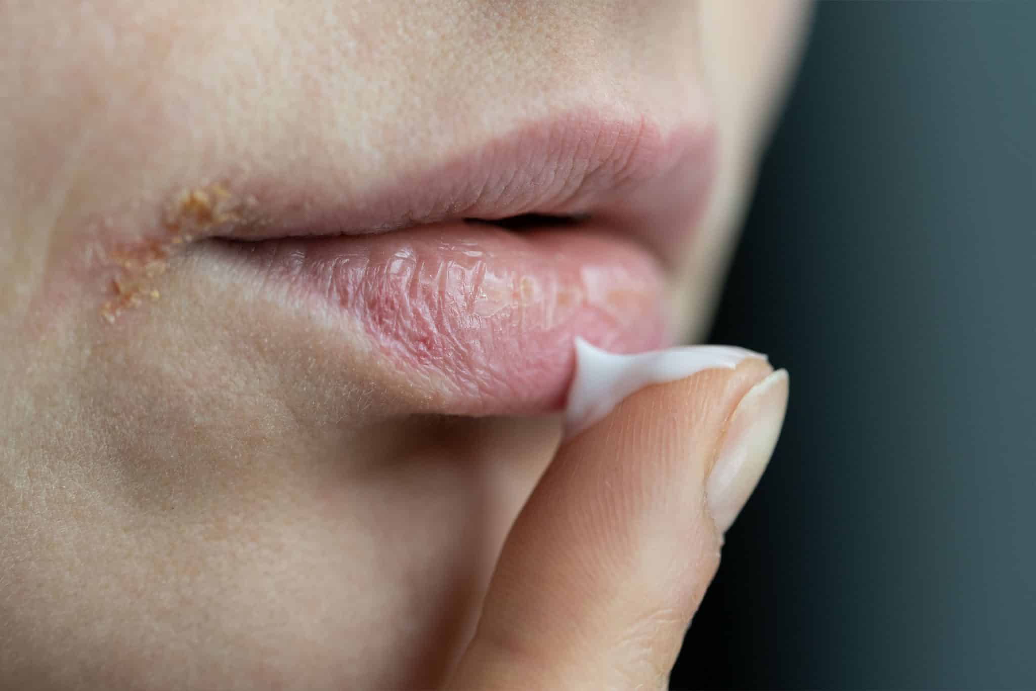 a photo of a woman applying lip balm
