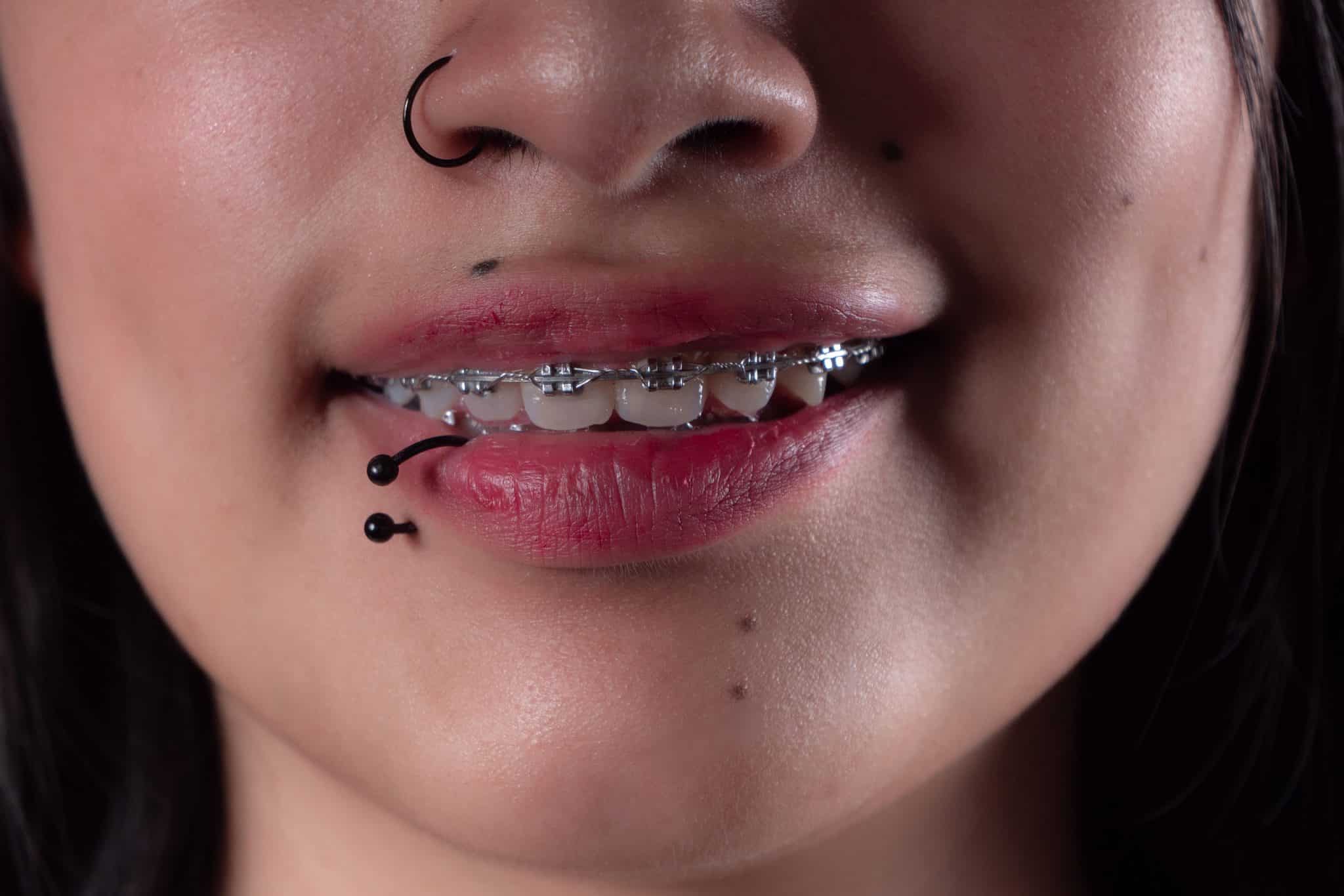A photo of a girl with a lip piercing and braces