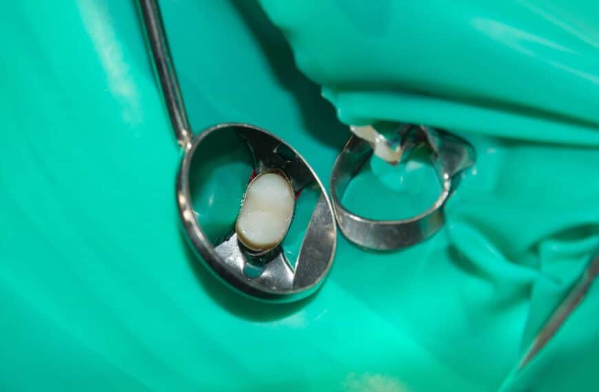 A picture of a tooth getting being prepped for a root canal.