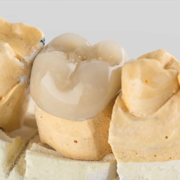 A picture of a tooth mold with a ceramic crown.