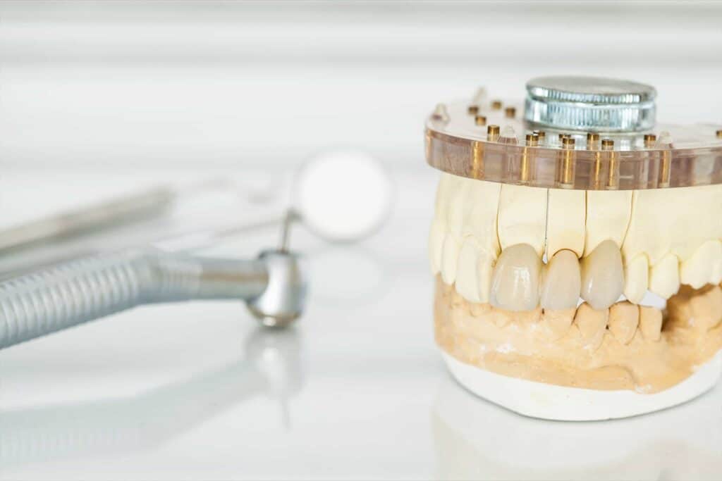 A photo of a dental tool used to illustrate crowns.