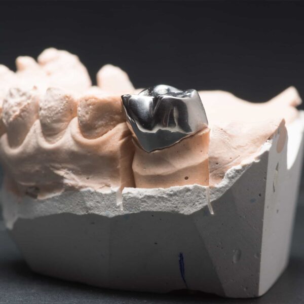 A picture of a tooth mold showing a metal crown.