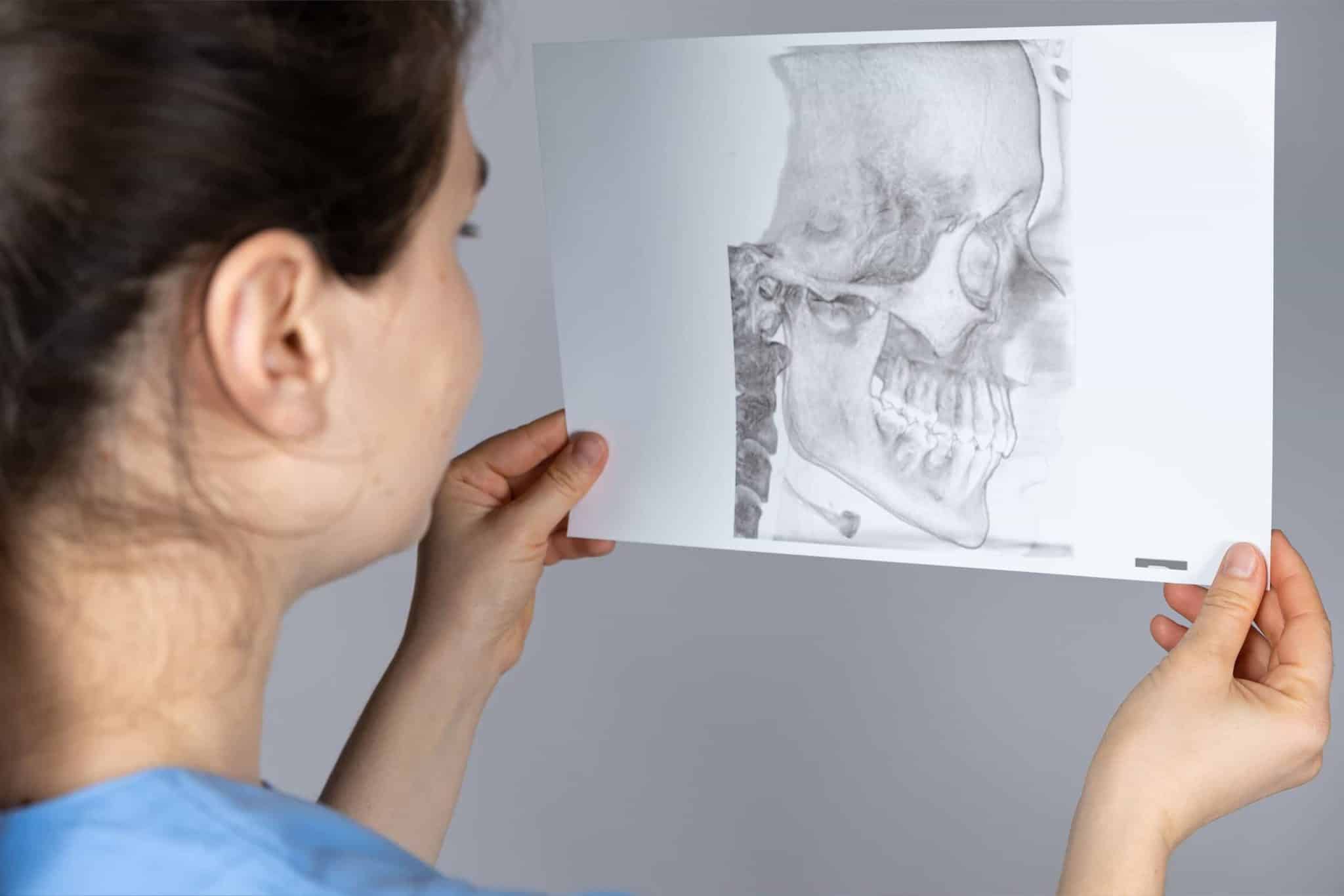 A woman looking at a CT scan of a temporomandibular joint.