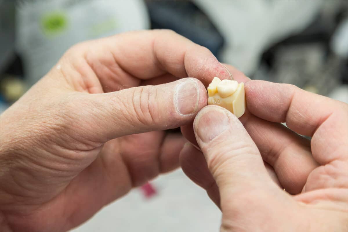 A technician holding a 3D-printed mold for tooth implants.