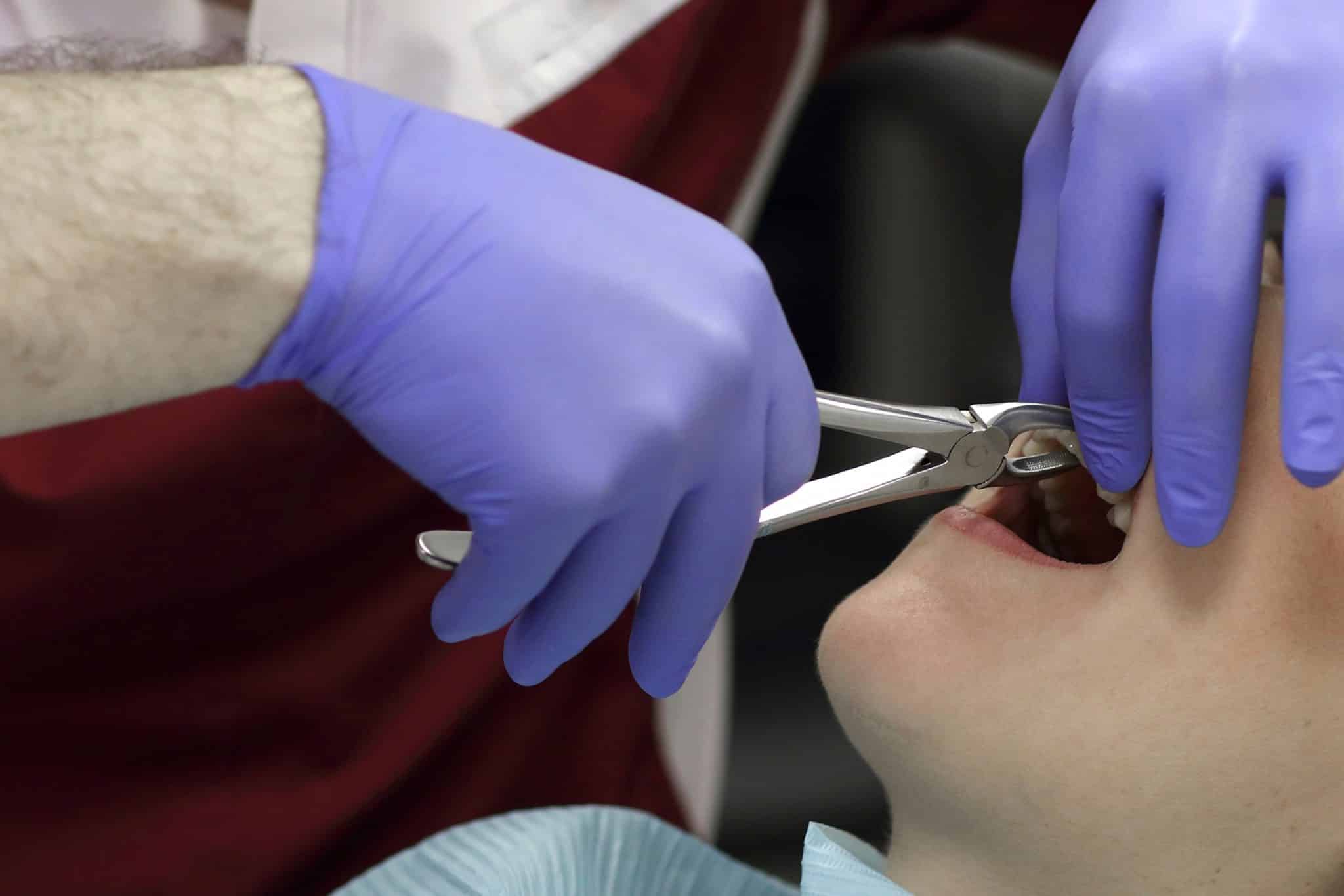 A photograph of a person getting a dental extraction.