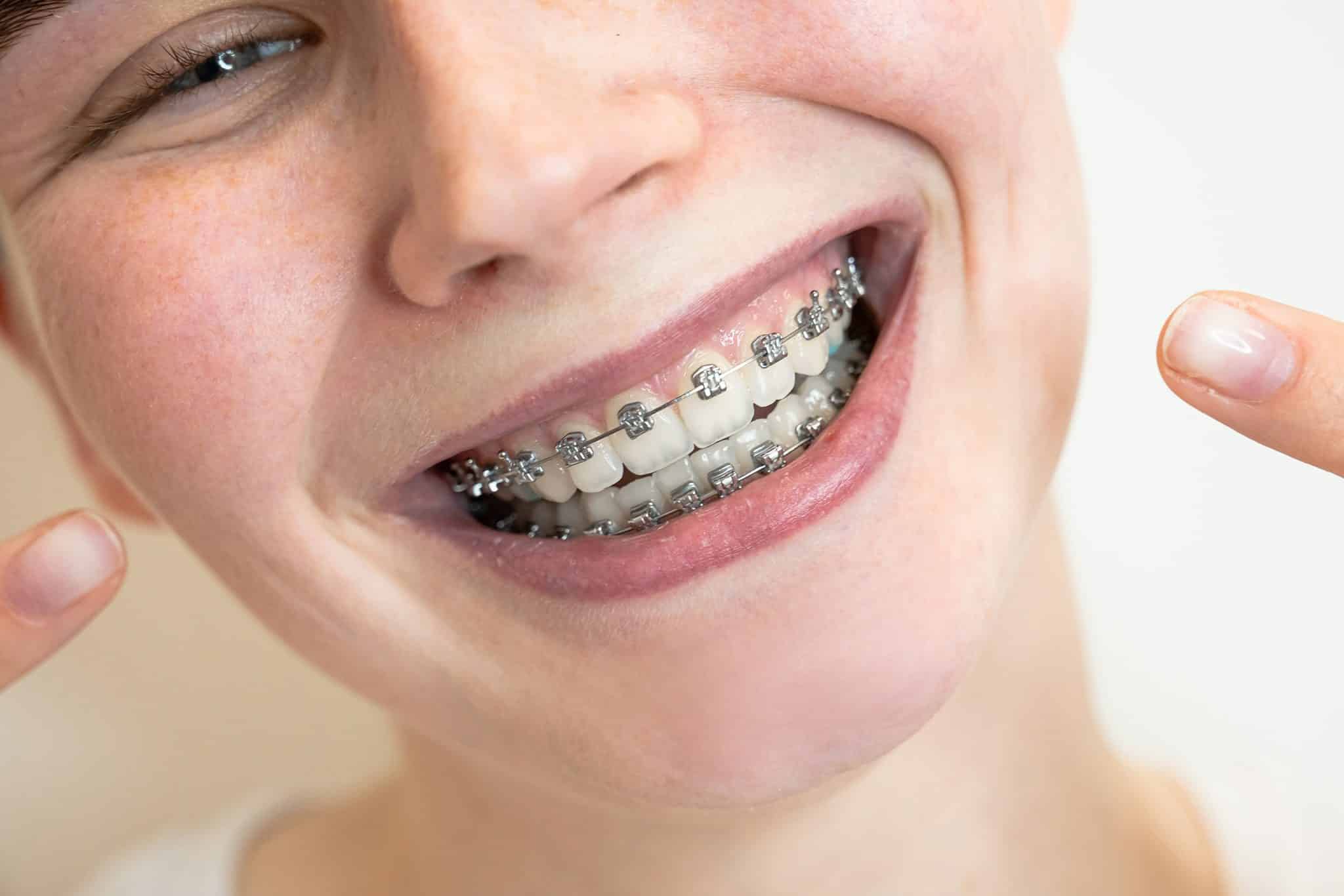 A young girl with braces.