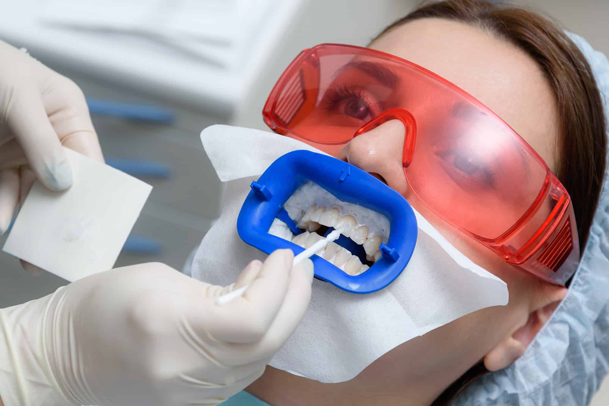 A picture of a patient getting teeth whitening done at a dental office.