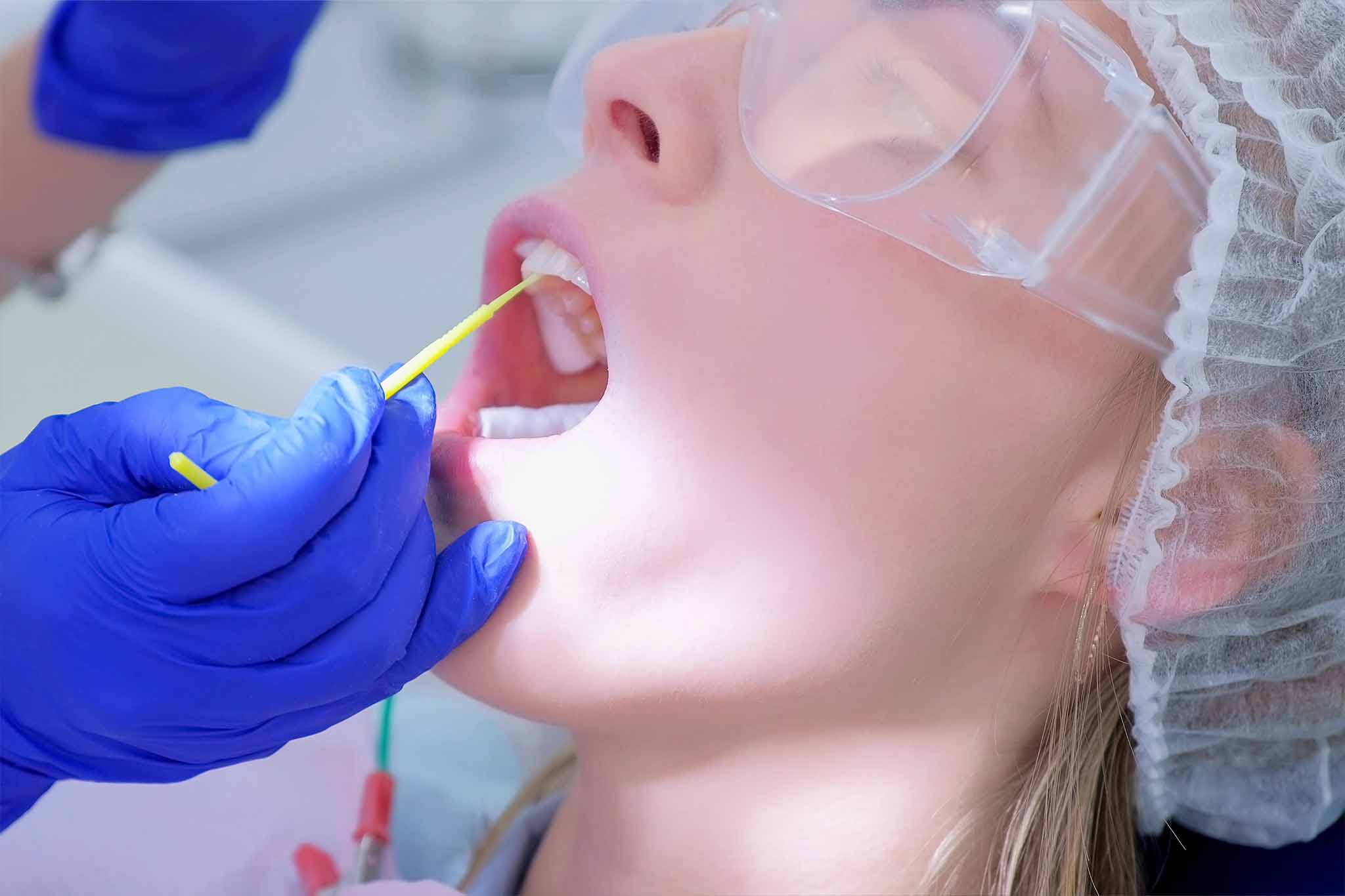 A patient is getting a fluoride treatment at the dentist.